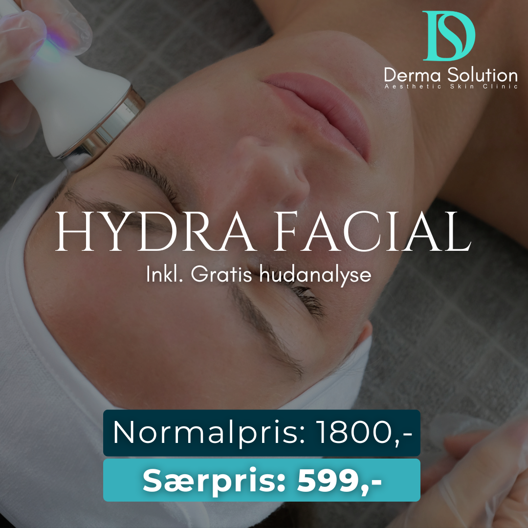 Derma Solution Copenhagen Facebook ad: Hydra Facial til 599 kr (Normalt 1800 kr)