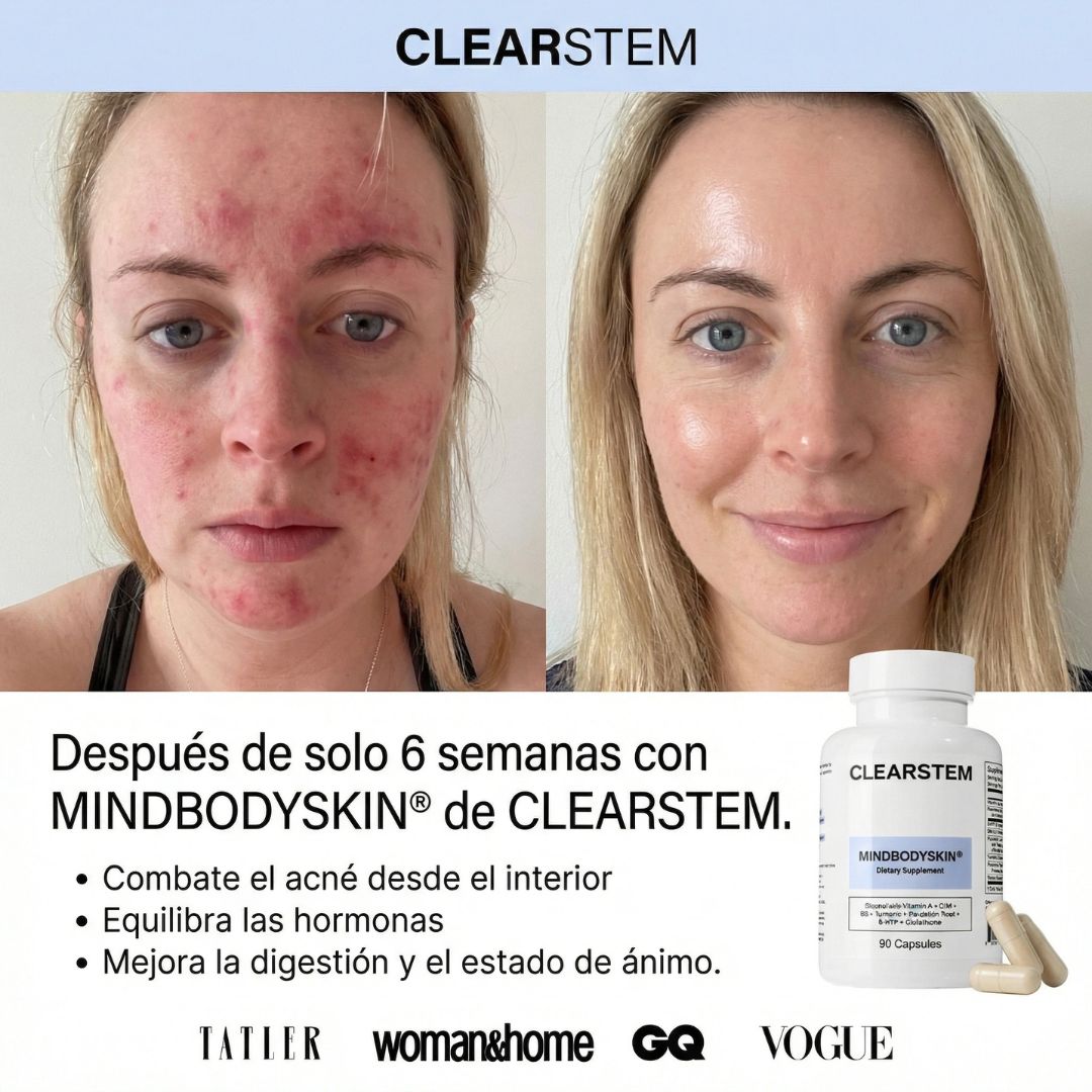 Belarya Facebook ad: Recupera la confianza en tu piel
