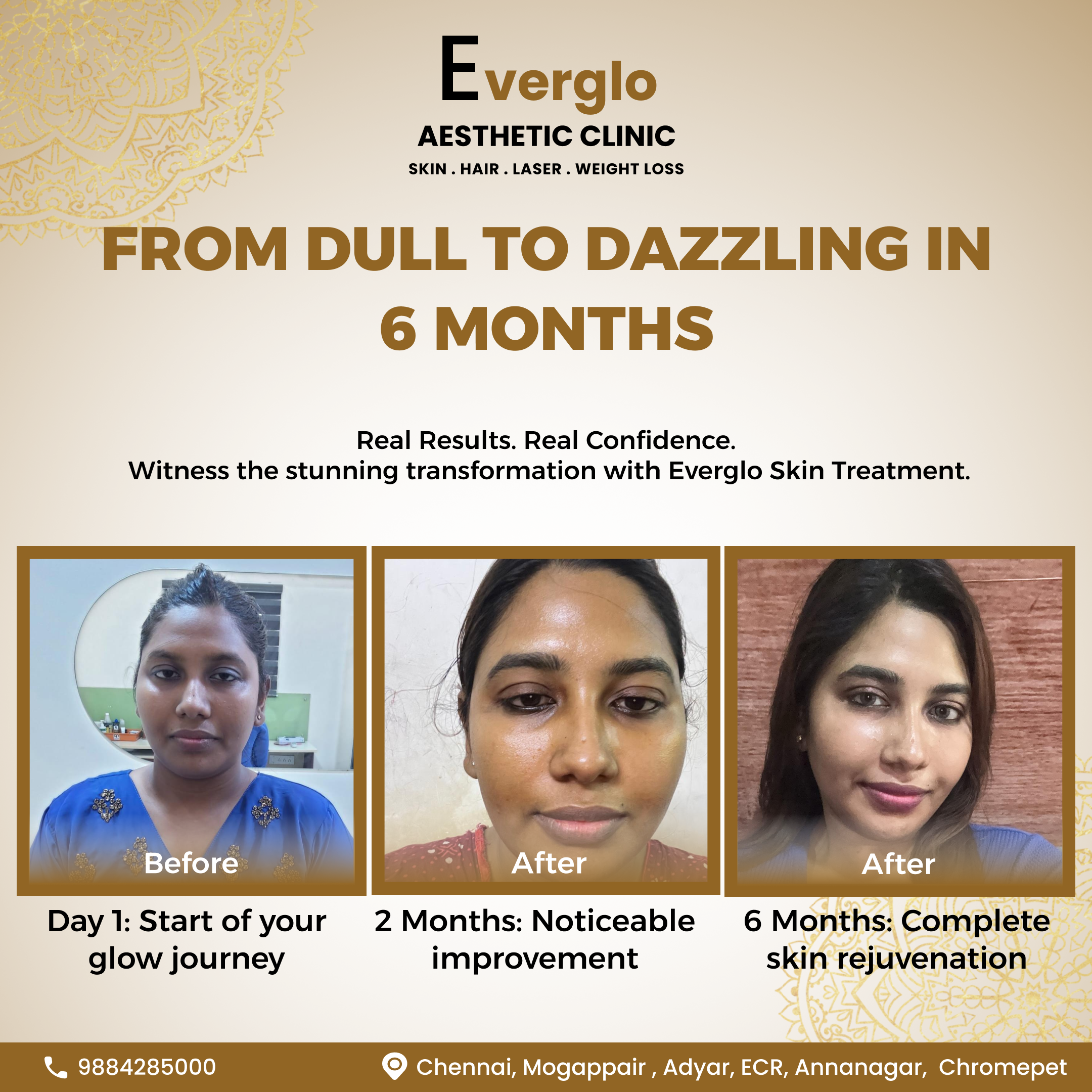 Evergloaesthetics.poonamallee Facebook ad