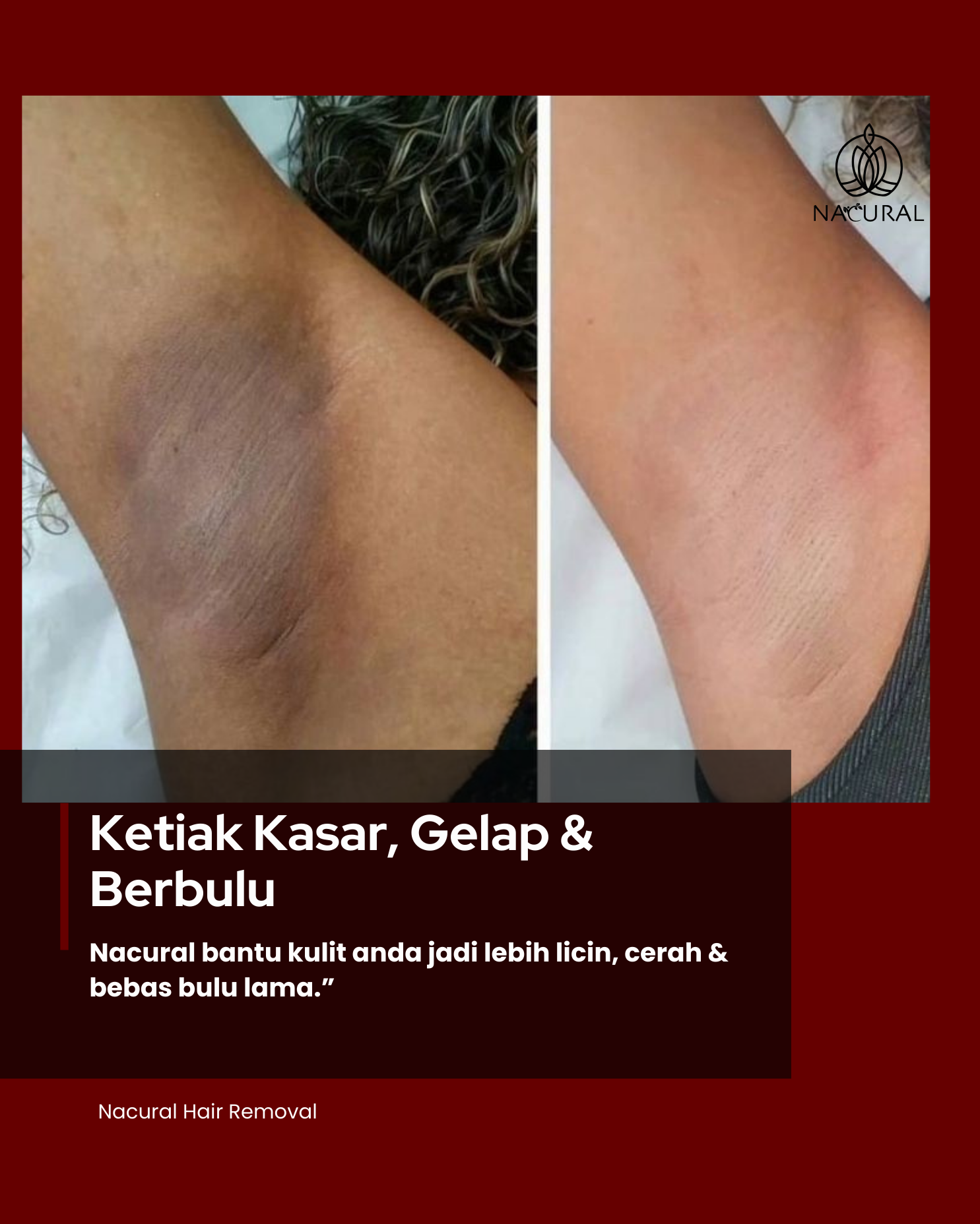 Nacural Pulau Pinang  Facebook ad