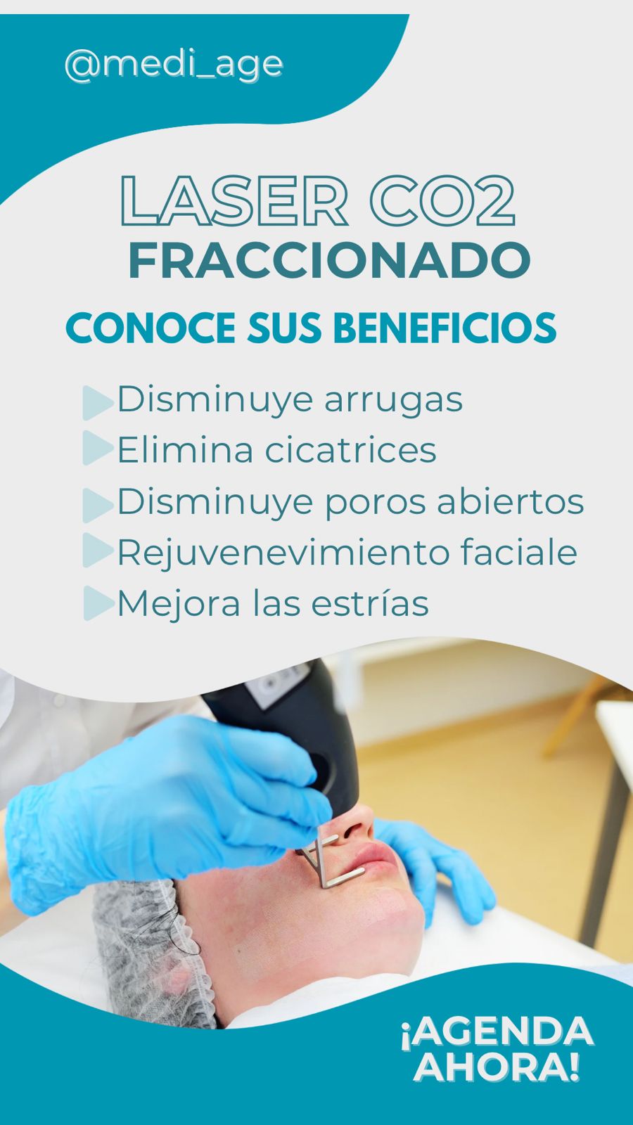 Medi age Facebook ad: laser co2
