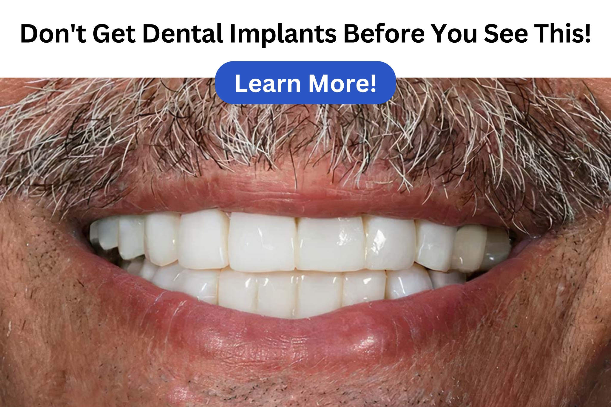 FeistyTips Facebook ad