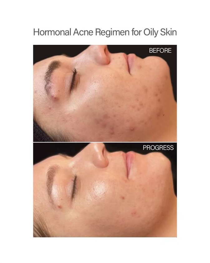 vivantskincare Facebook ad