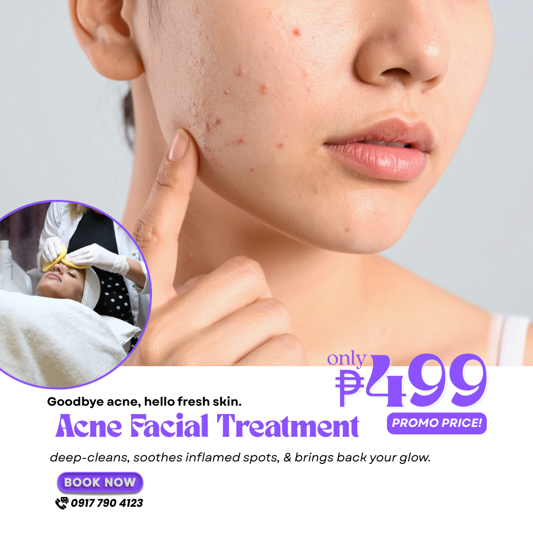 Predire Wellness Facebook ad: Acne Facial Treatment for ONLY ₱499