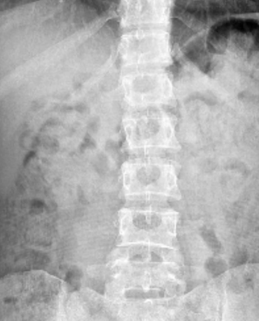 Better Digestion Daily Facebook ad
