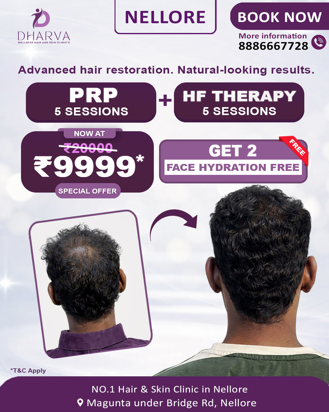 Dharva Wellness Hair And Skin Clinics Facebook ad