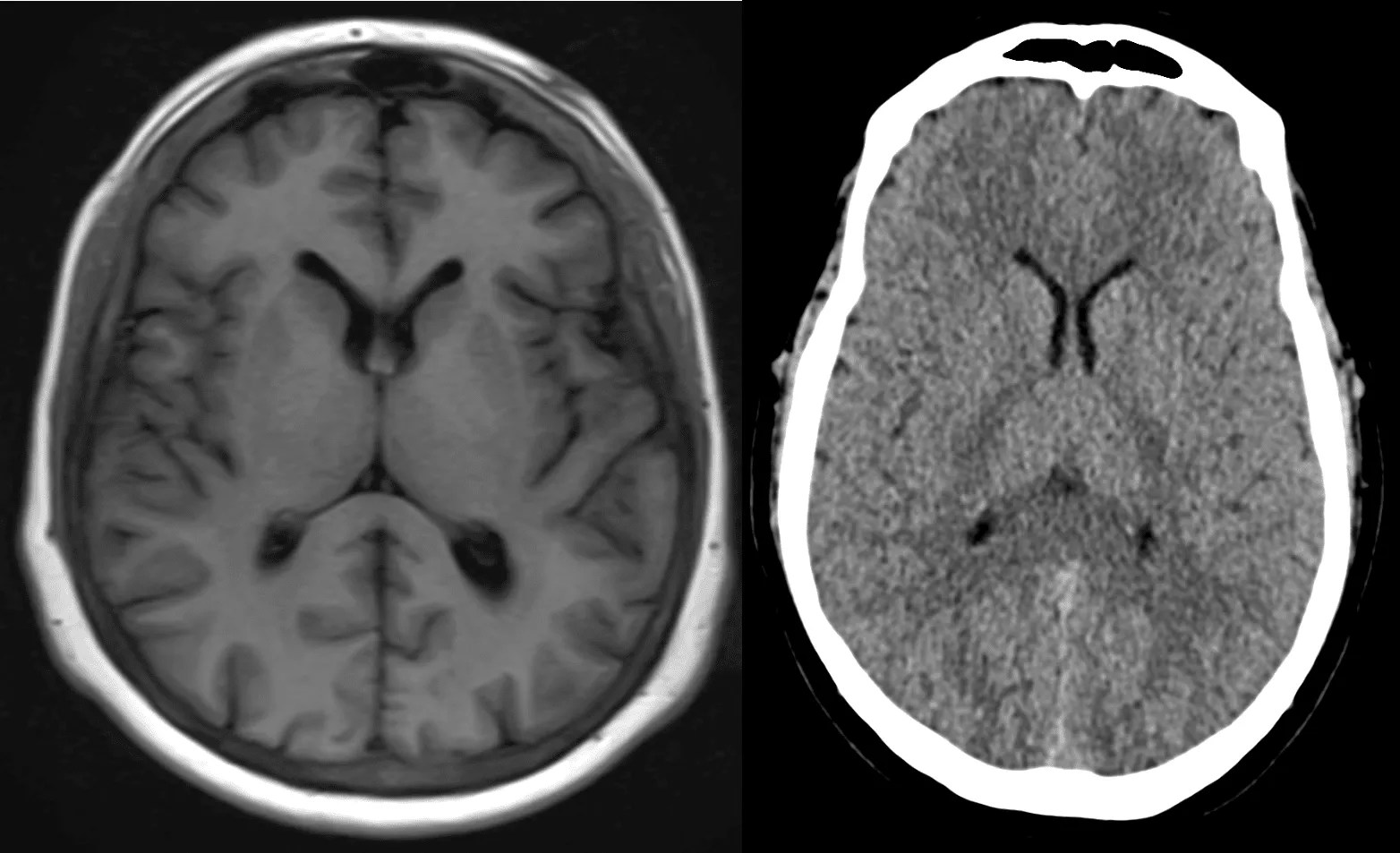 Sabrina Roger, MD Neuromuscular Specialist Facebook ad: I'm A Neurologist. I've Seen Normal B12 Results Destroy A…
