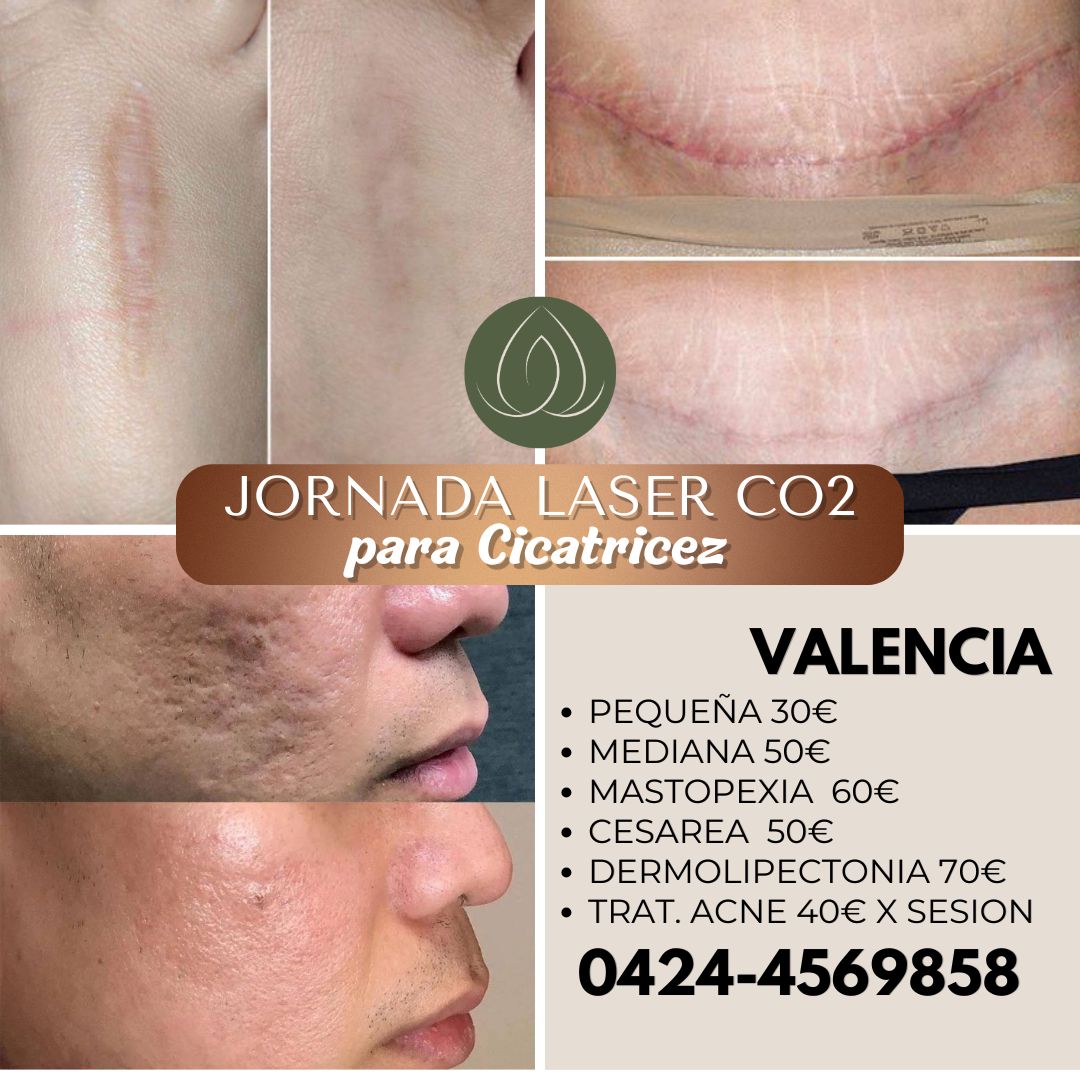 Nelum Spa Facebook ad: Instagram