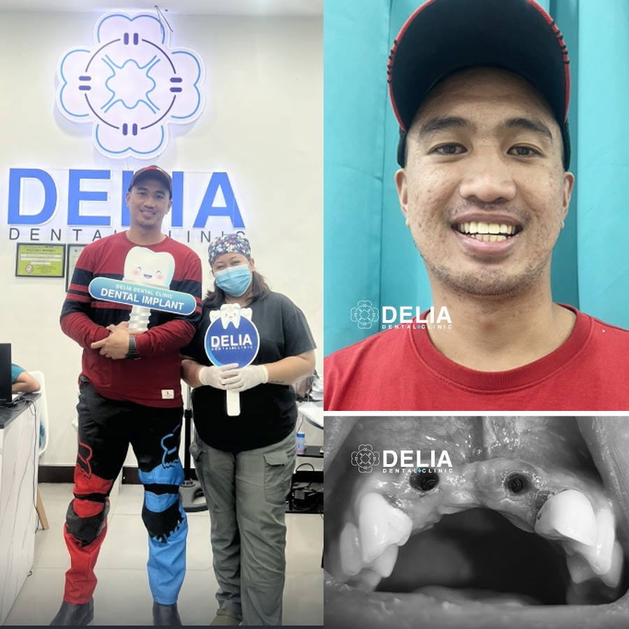 Delia Dental Clinic Facebook ad
