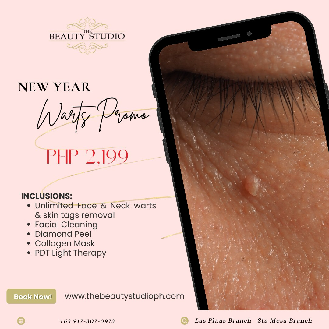 The Beauty Studio Facebook ad: Goodbye Warts!