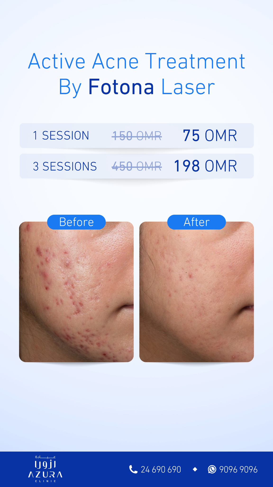 Azura Clinic Facebook ad