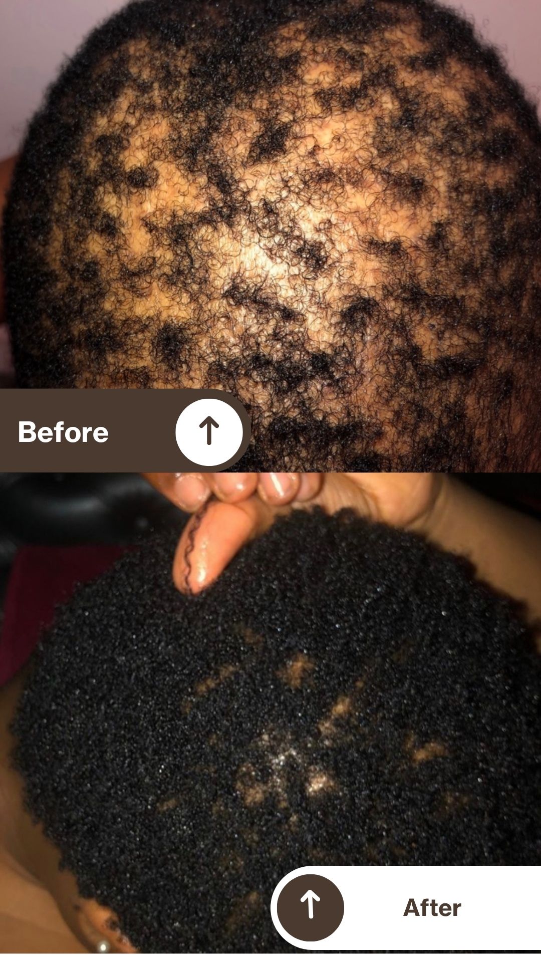 afrohaircandy Facebook ad: If your hair is thinning, breaking, or not…