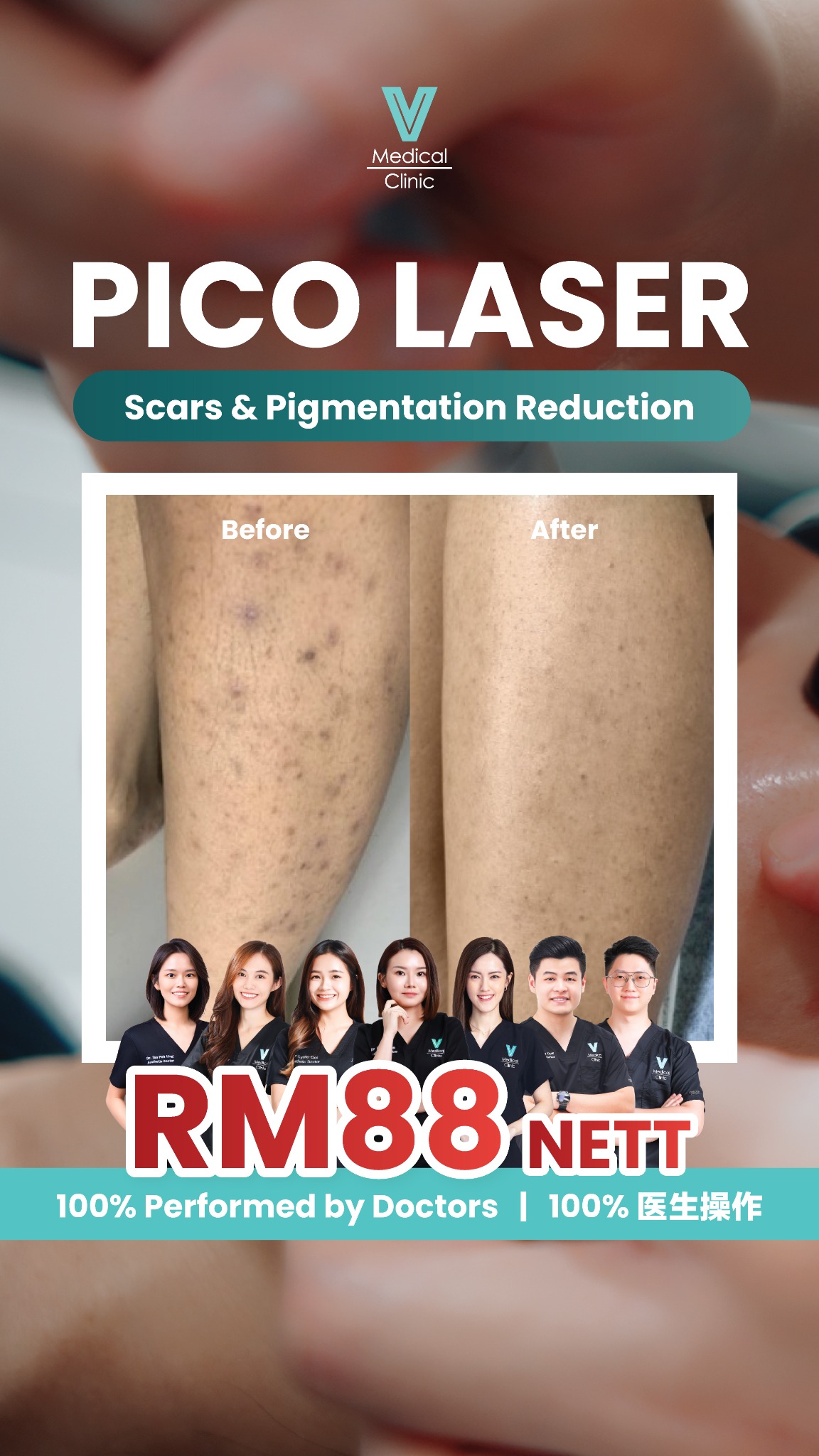 V Medical Clinic Malaysia Facebook ad
