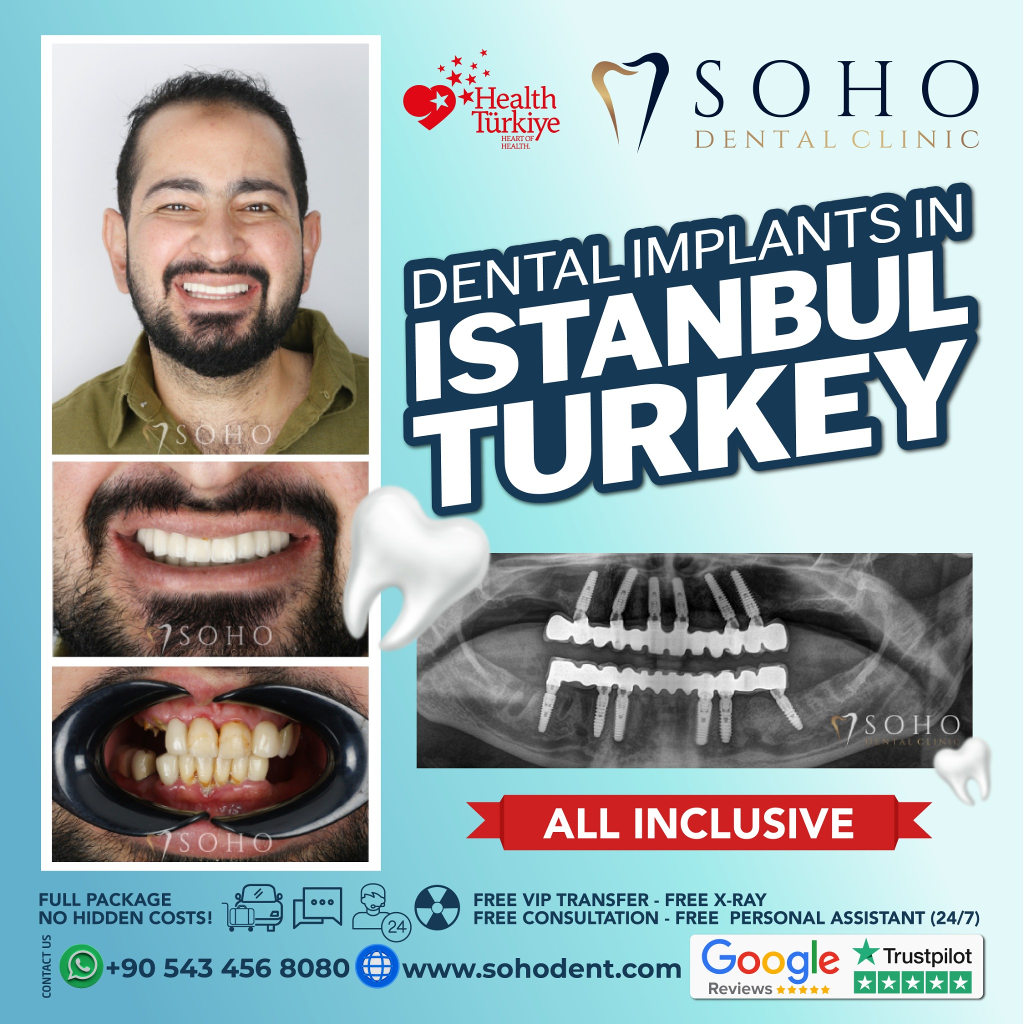 Soho Dental Clinic Facebook ad: Dental Treatment in Turkey