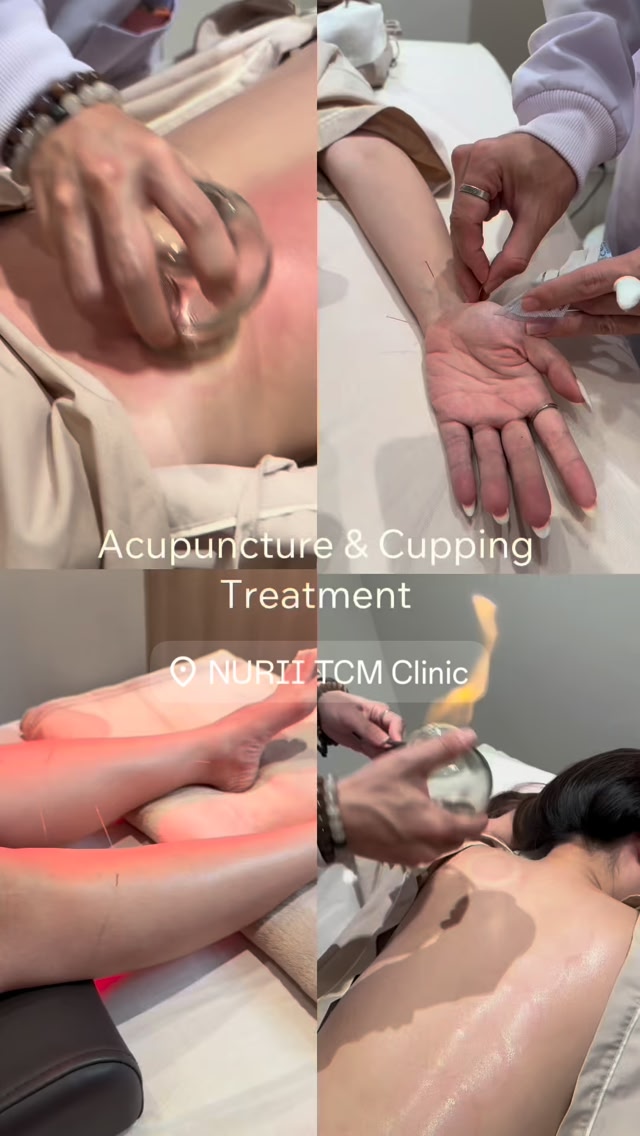 NURII TCM Clinic Facebook ad: แพทย์แผนจีนของแท้โดยแพทย์ระดับอาจารย์อยู่ที่นี่แล้ว