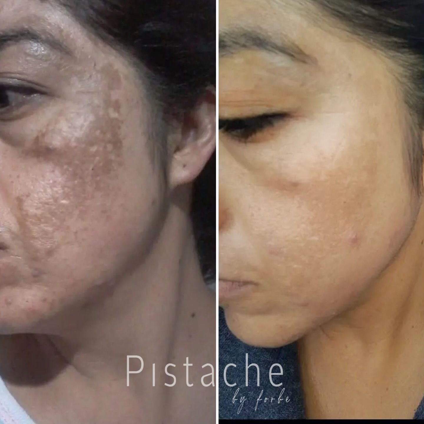 Pistache Facebook ad: Hoy fue ella… mañana puedes ser tú