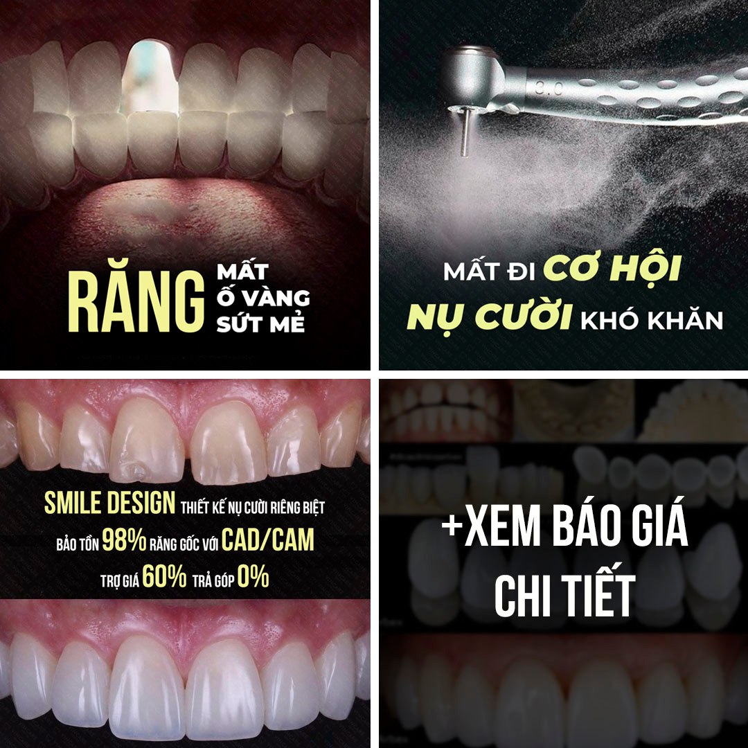 Nha Khoa Quy Chuẩn Quốc Tế Vincare Dental Facebook ad: Bọc răng sứ 16 răng trọn gói chỉ…