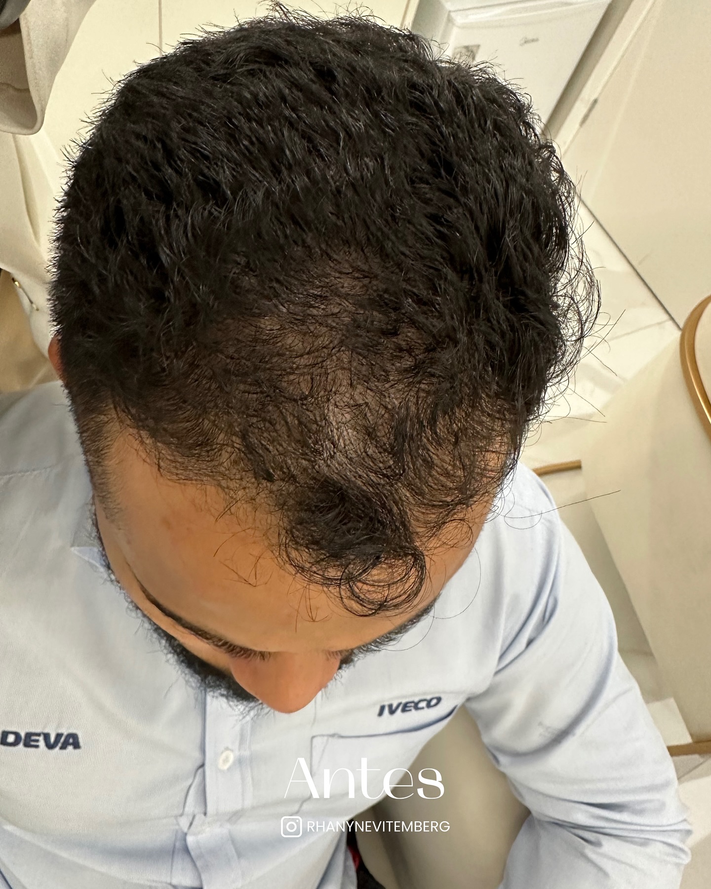 Dra. Rhanyne Vitemberg Facebook ad: Você sabia que queda de cabelo, afinamento dos…
