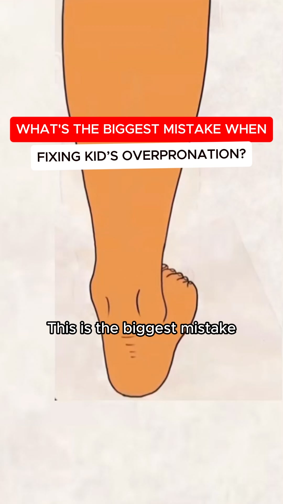 Footstr Facebook ad: Support Flat Feet the Right Way