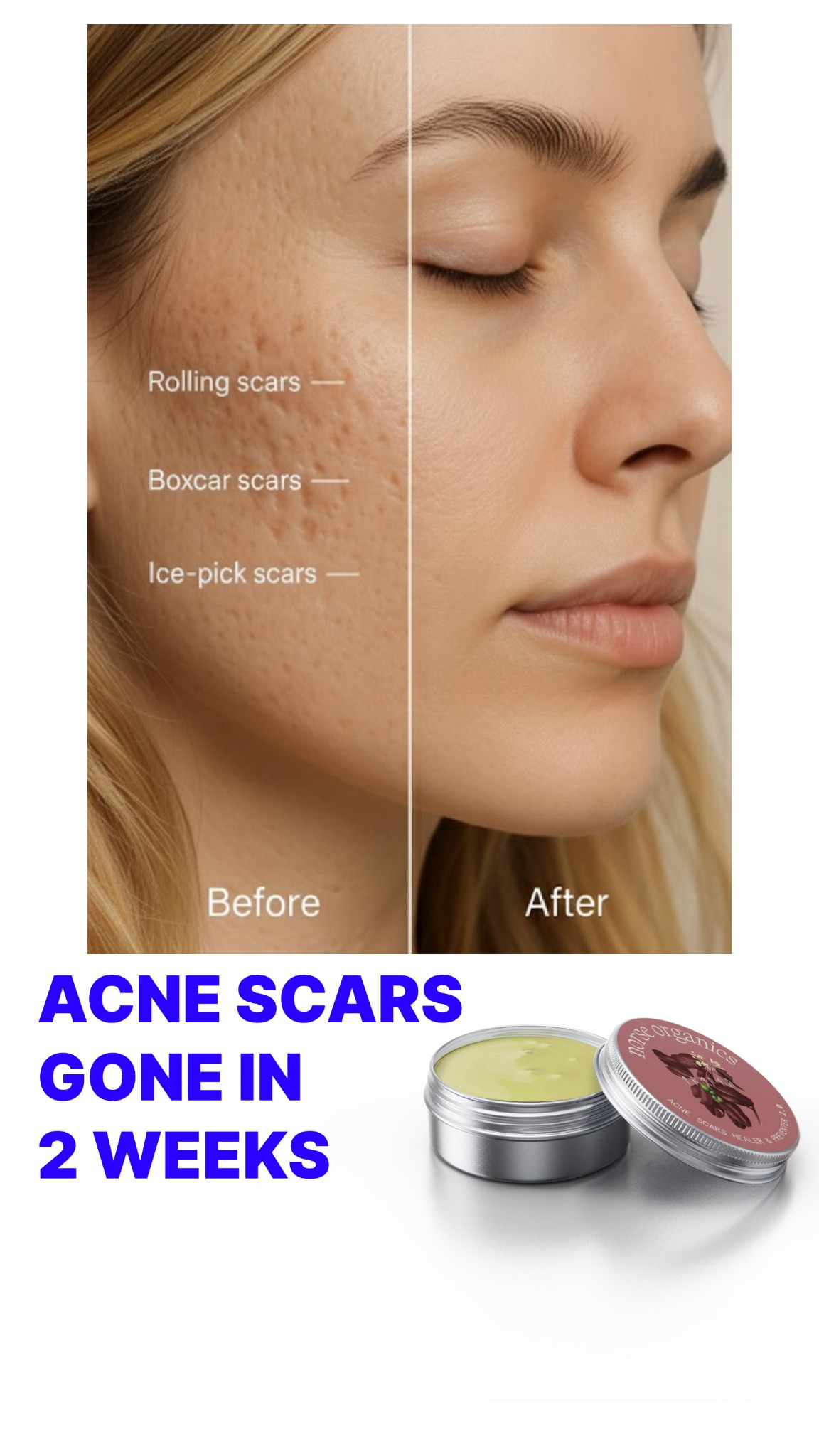Anne's Skincare Blog Facebook ad