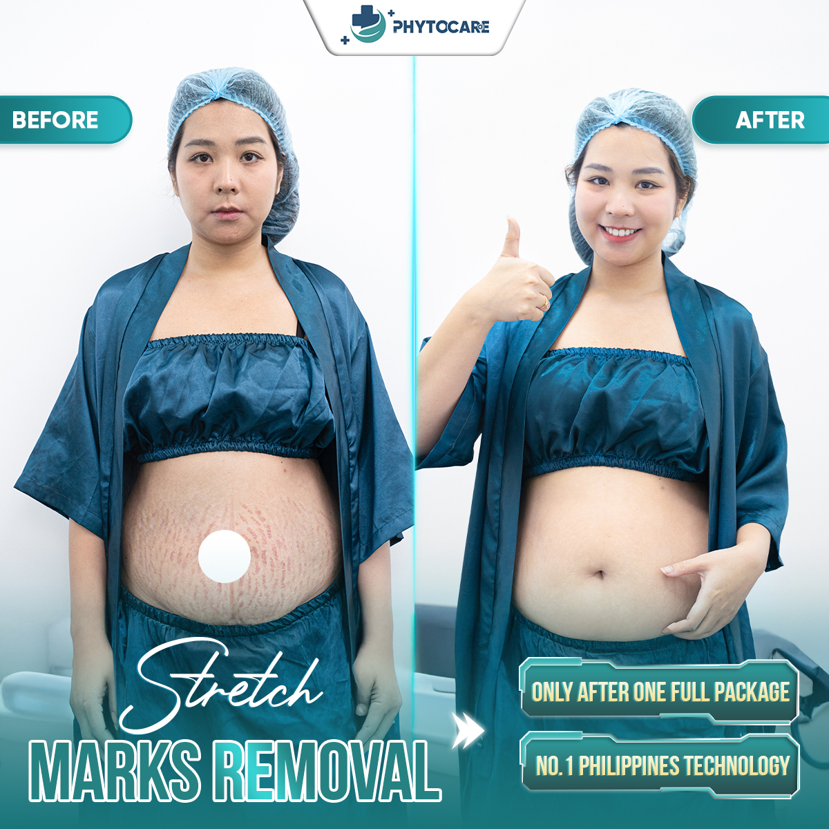 The Top1 scar treatment and skincare clinic in Makati Facebook ad: Chat trong Messenger