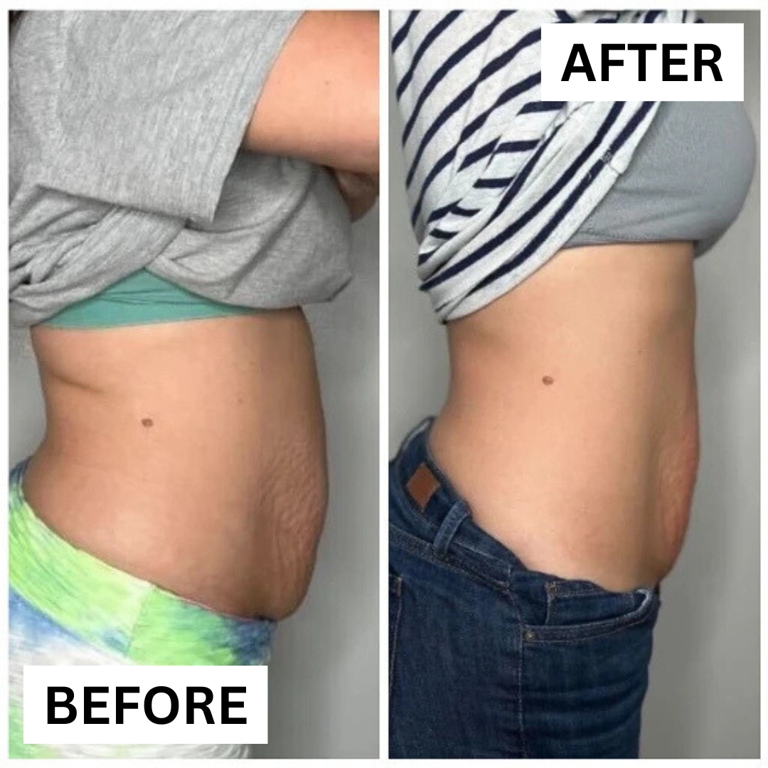 Alabama Wellness & Aesthetics Facebook ad: Slimdown Special NOW $99