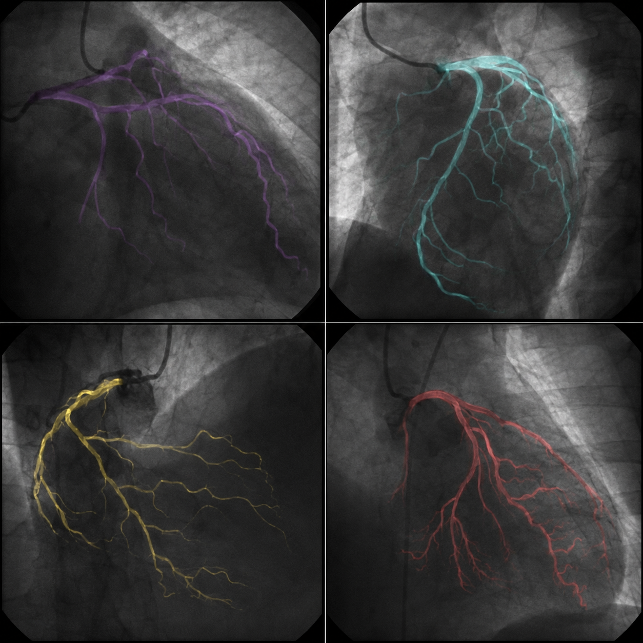 Dr. Lisa Park, Naturopathic MD Facebook ad: when a cardiologist becomes the patient