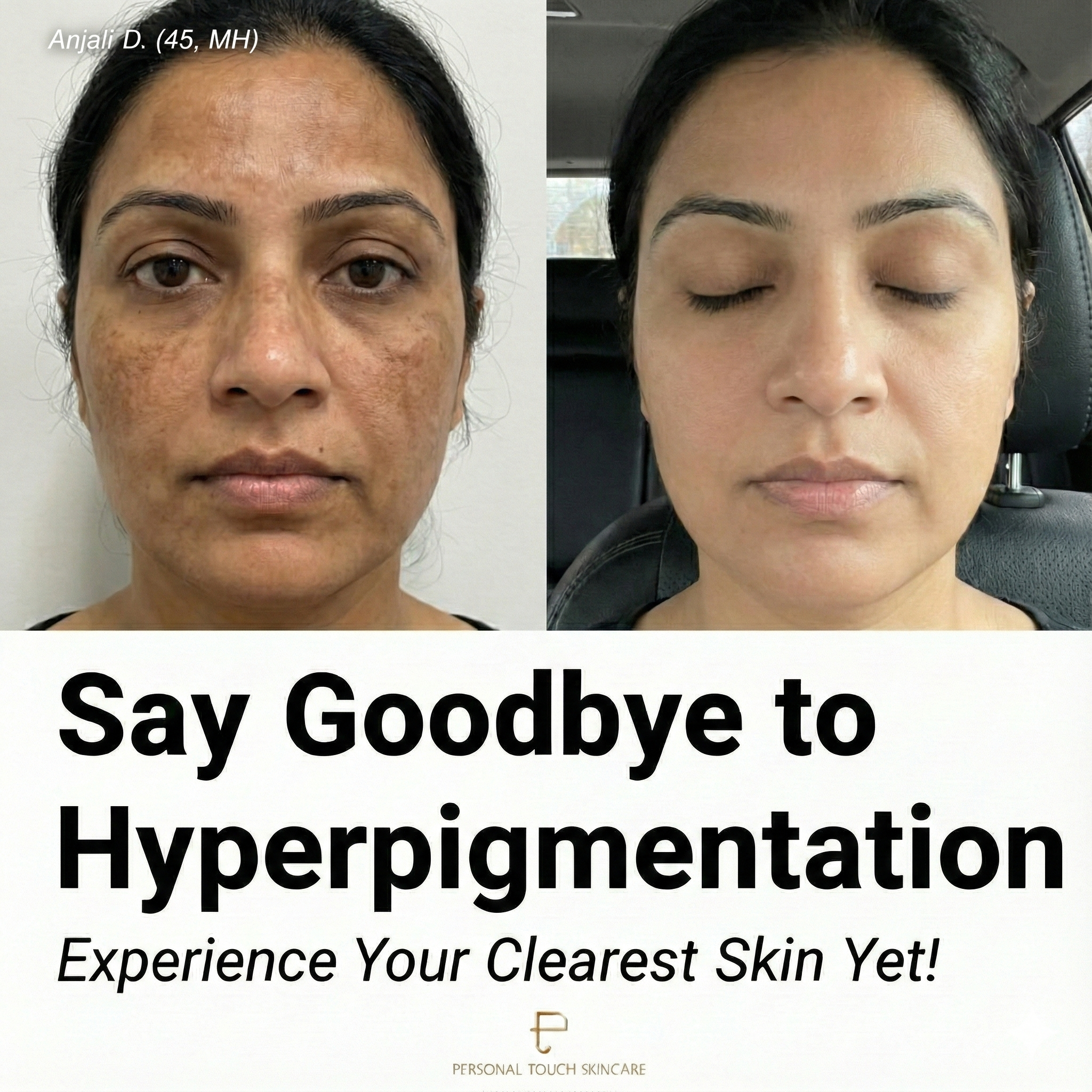 Personal Touch Skincare India Facebook ad