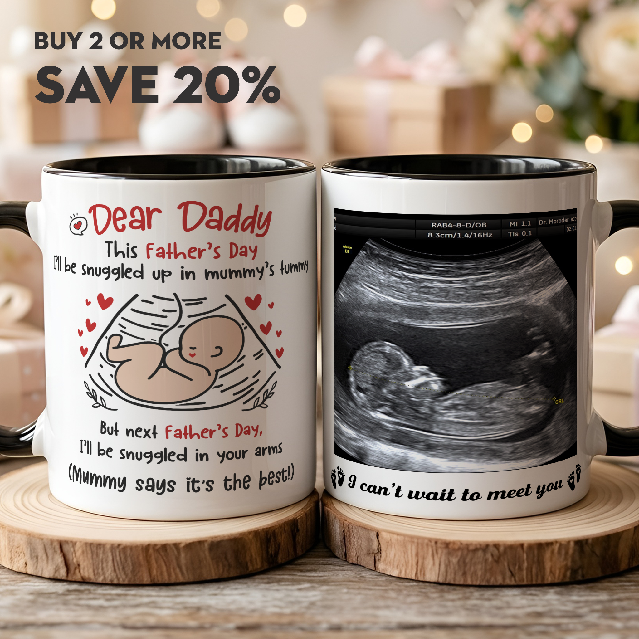 New to Nest - Personalised Gifts Facebook ad: Personalized Dad To Be Two Tone Mug with Ultrasound Photo…
