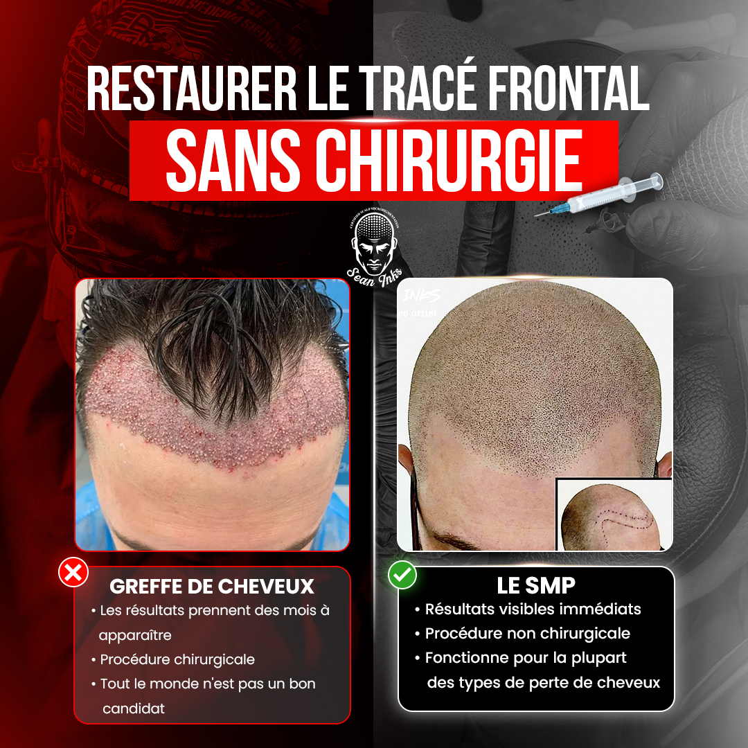Hair Loss Solution SMP by Sean Inks Facebook ad: Québec, 15 % de réduction sur la micropigmentation du cuir…