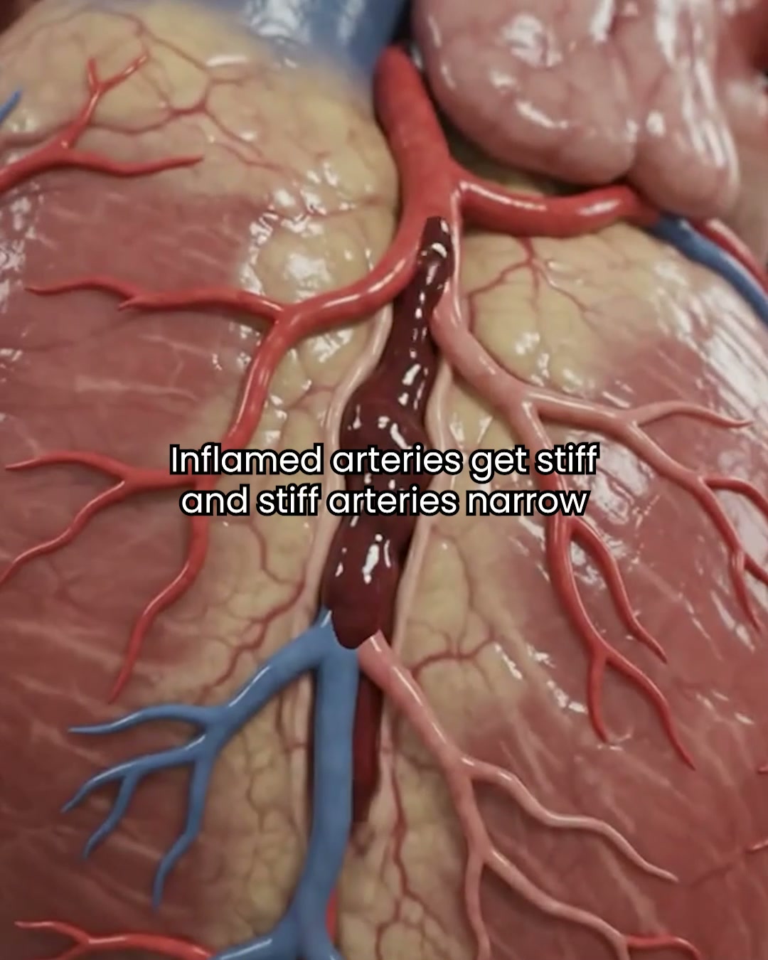 Inner Dose Facebook ad: Support BP & Cholesterol Naturally