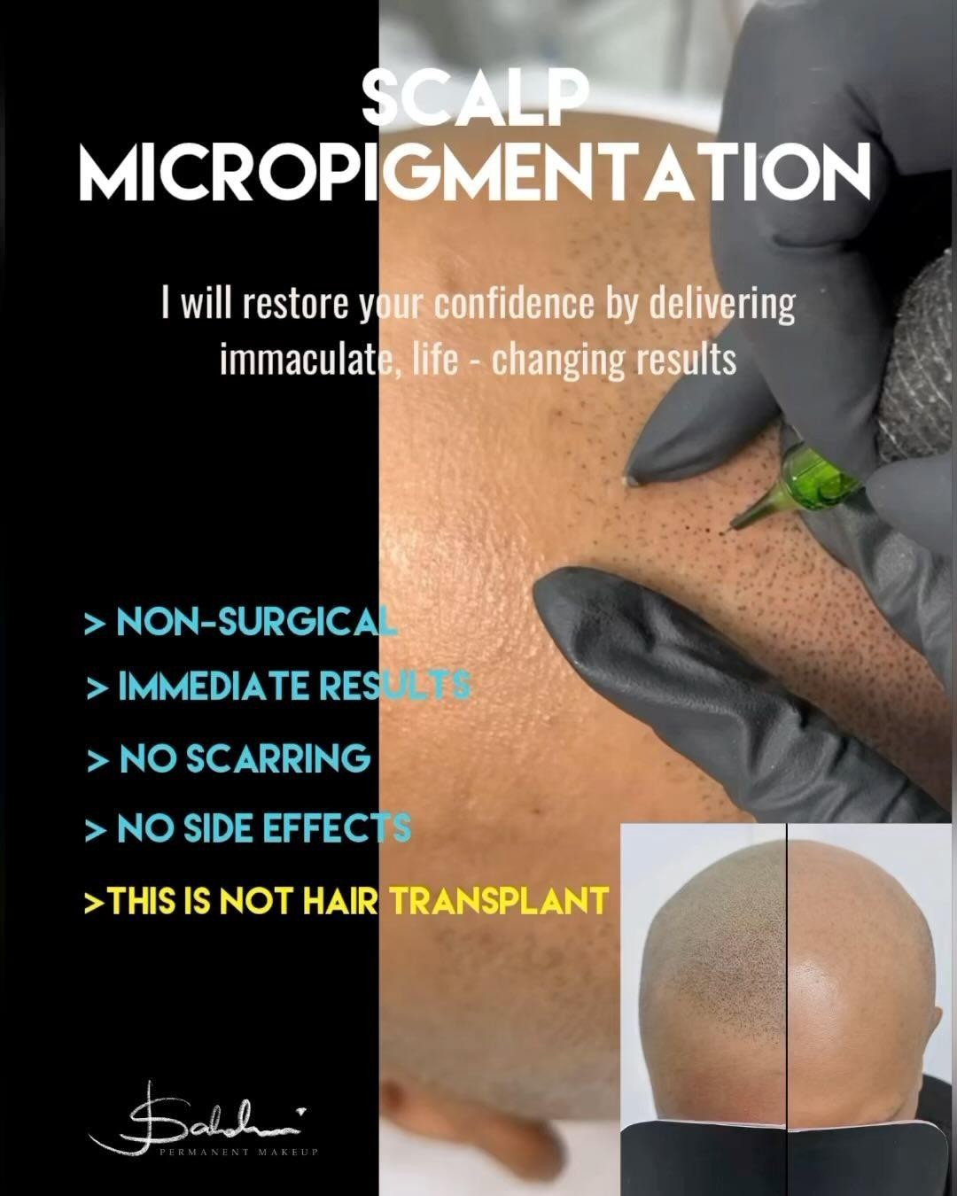 Jo Saldini PMU Facebook ad: SMP (Scalp Micropigmentation)