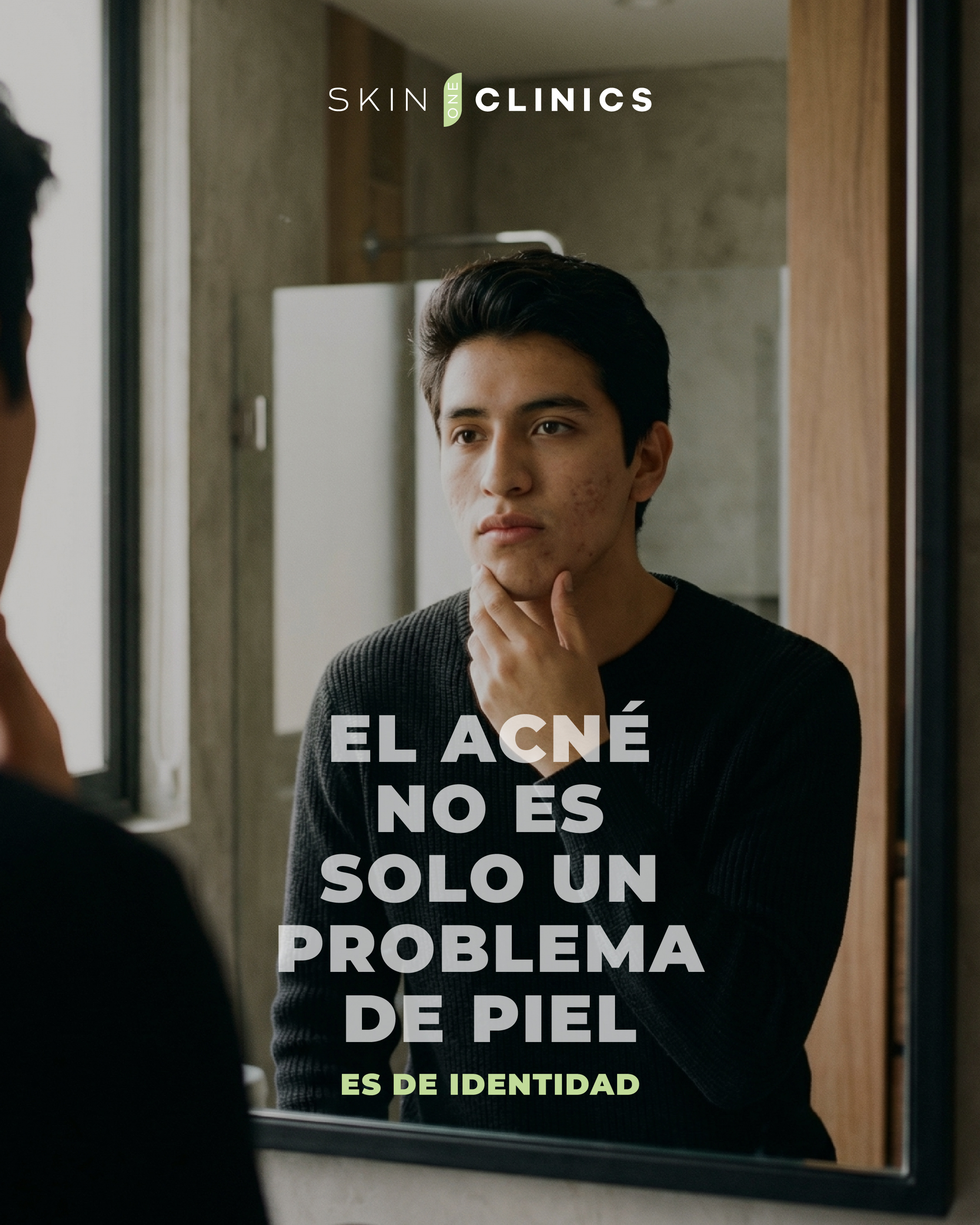 SkinClinics Facebook ad: ¿Sabías que el acné tiene solución real?