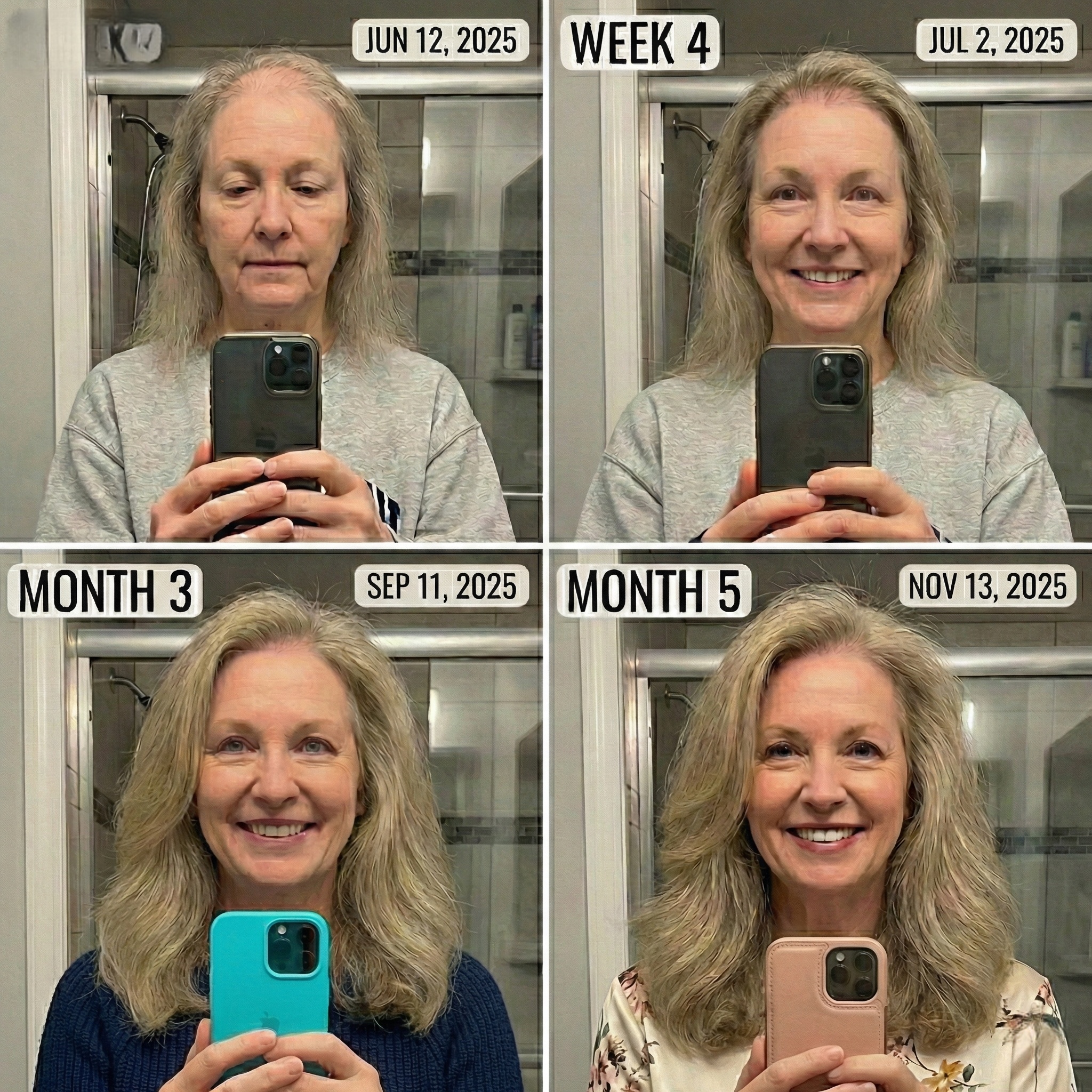 Linda Barrett Facebook ad: I Wish I Had Known About This Scalp Stamping Technique…