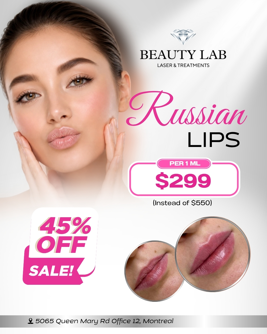 Beauty Lab Laser Facebook ad