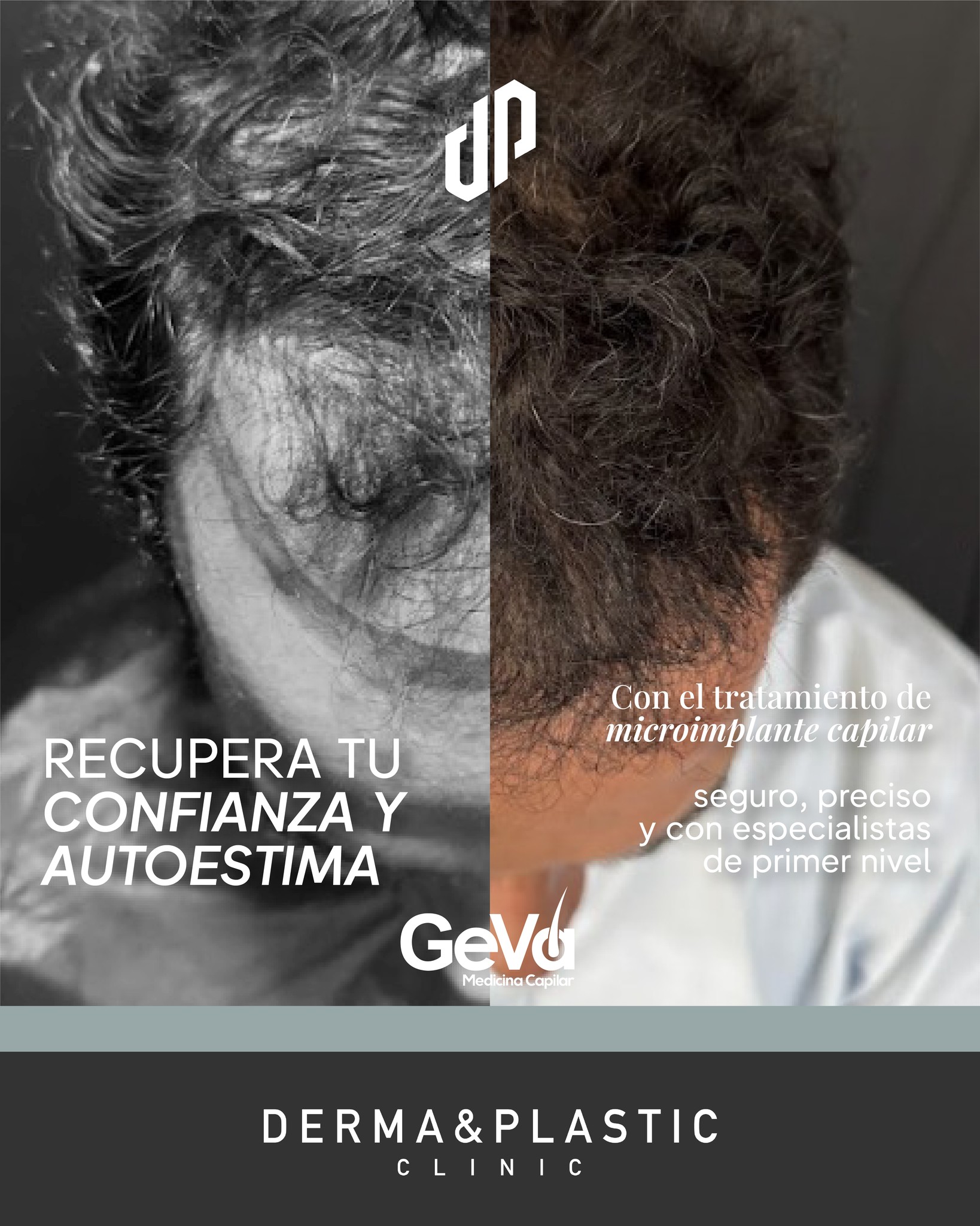 DermaPlastic Facebook ad