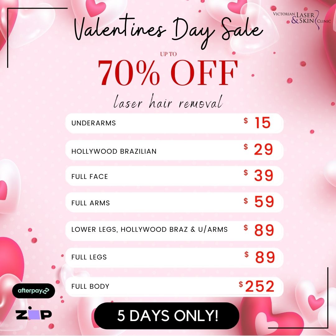 Victorian Laser & Skin Clinic Facebook ad: Valentine's Day Super Sale | Up to 70% Off | 5 Days Only |…
