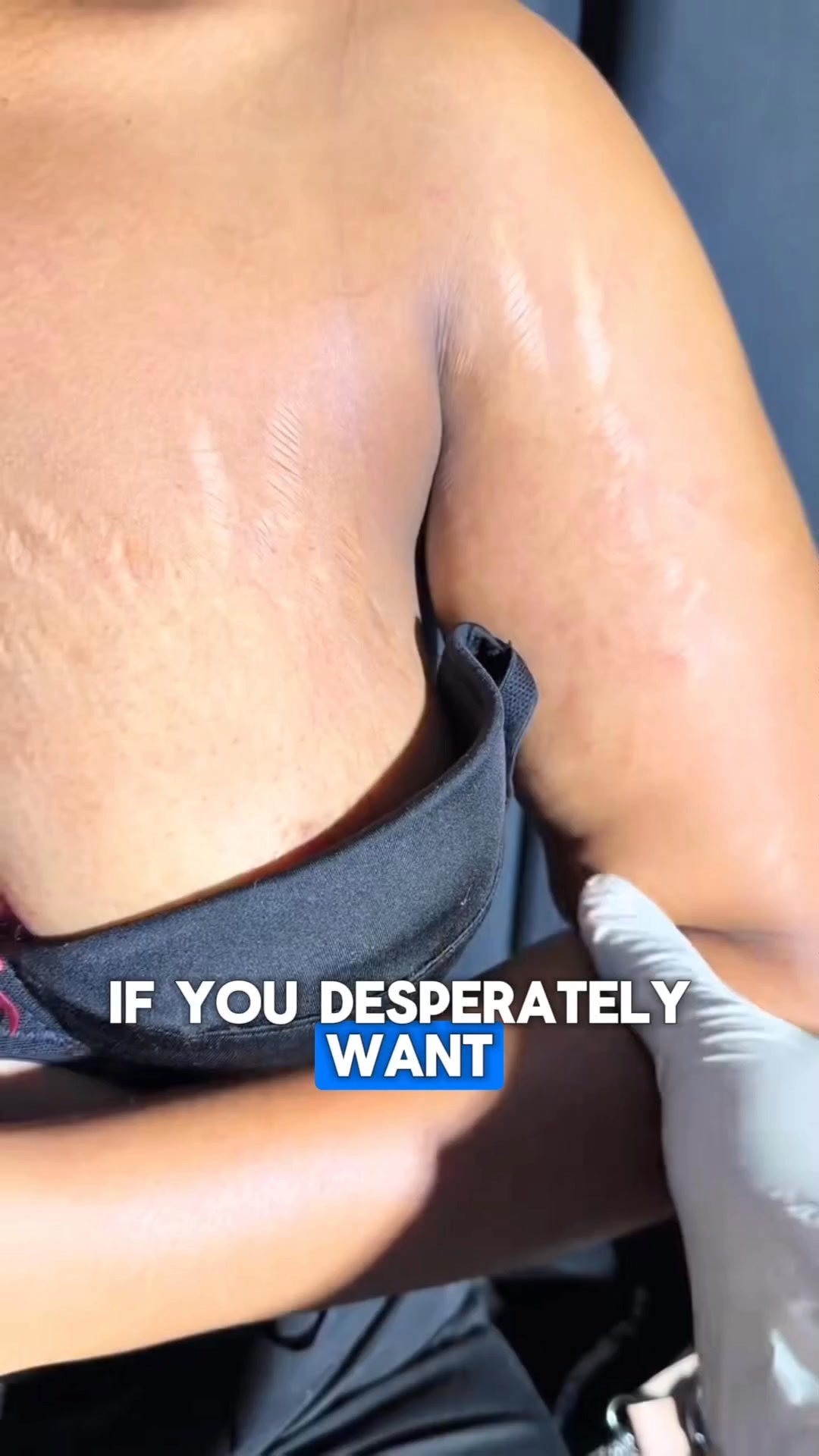 Clearovia Oil Facebook ad: Want to Fade 5-10 Year Old Stretch Marks and Scars?
