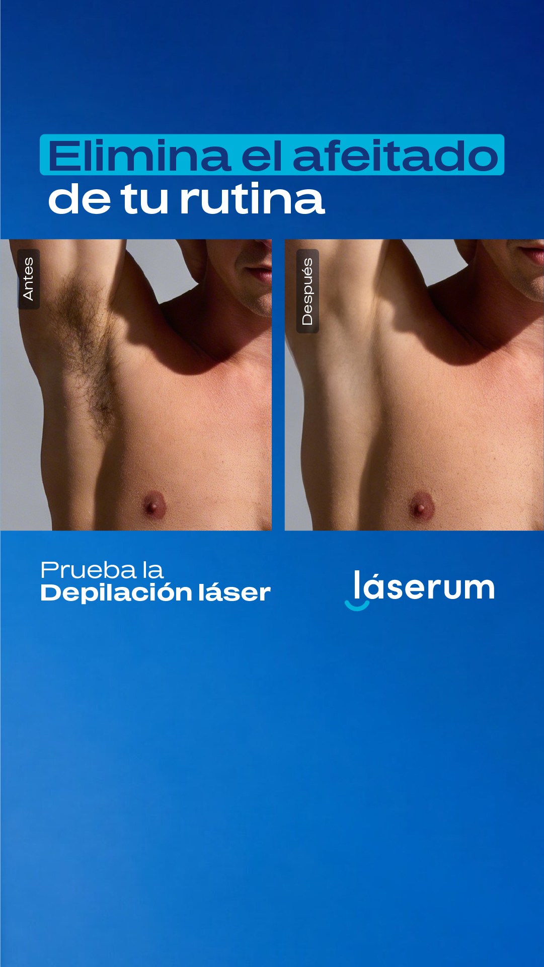 Láserum Facebook ad