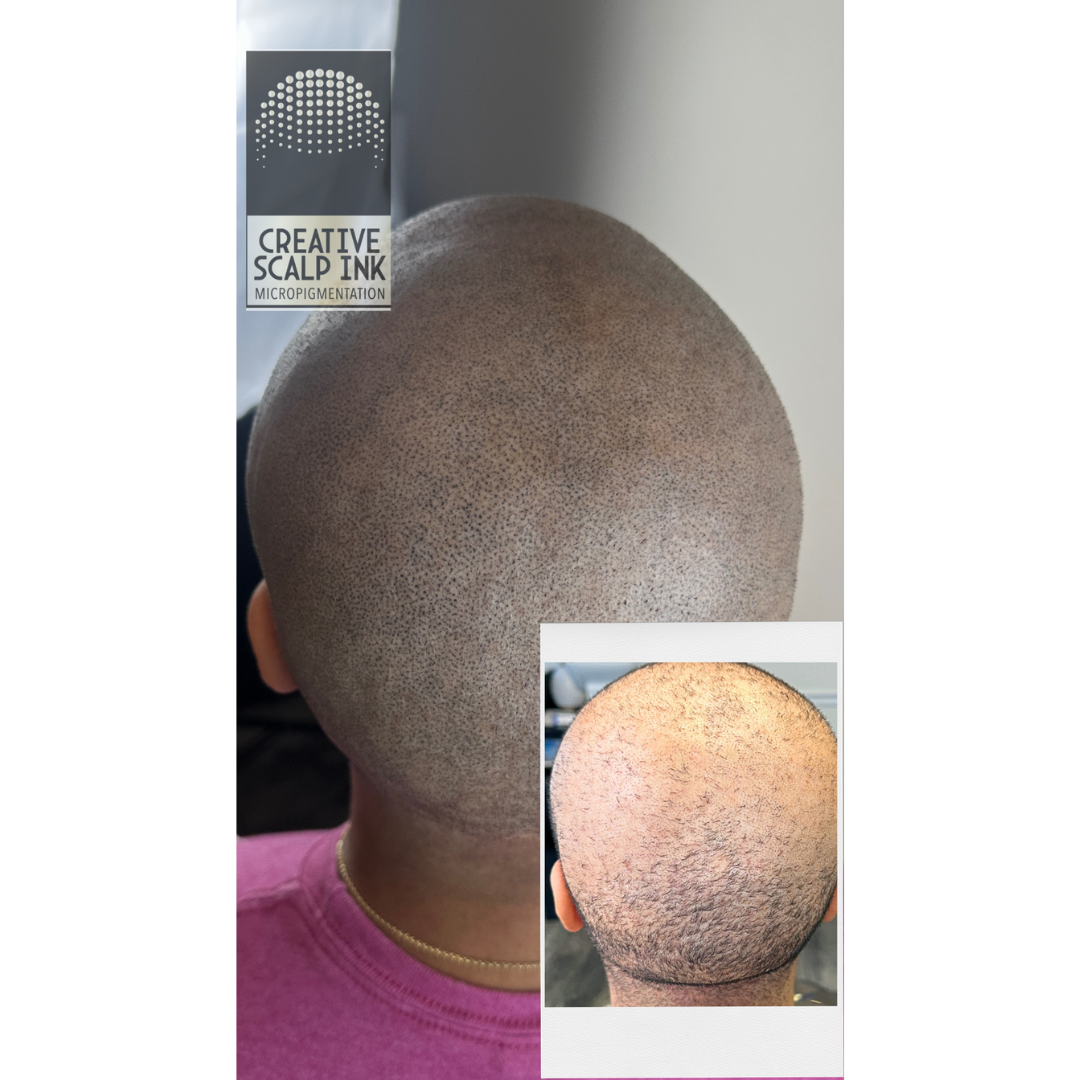 Creative Scalp Ink Facebook ad from Jan 20, 2026