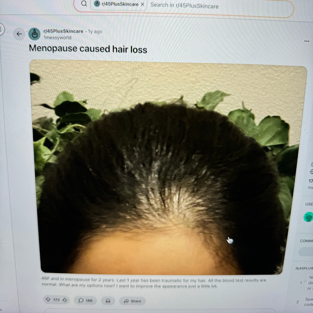 Personalized Hair Care Facebook ad: You’re Not Losing Your Hair, Your Scalp Is Starving