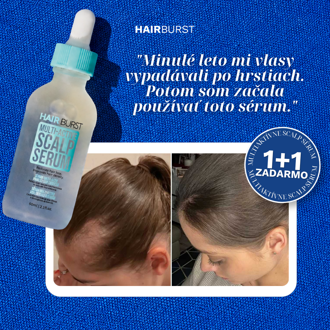 Hairburst SK.CZ Facebook ad