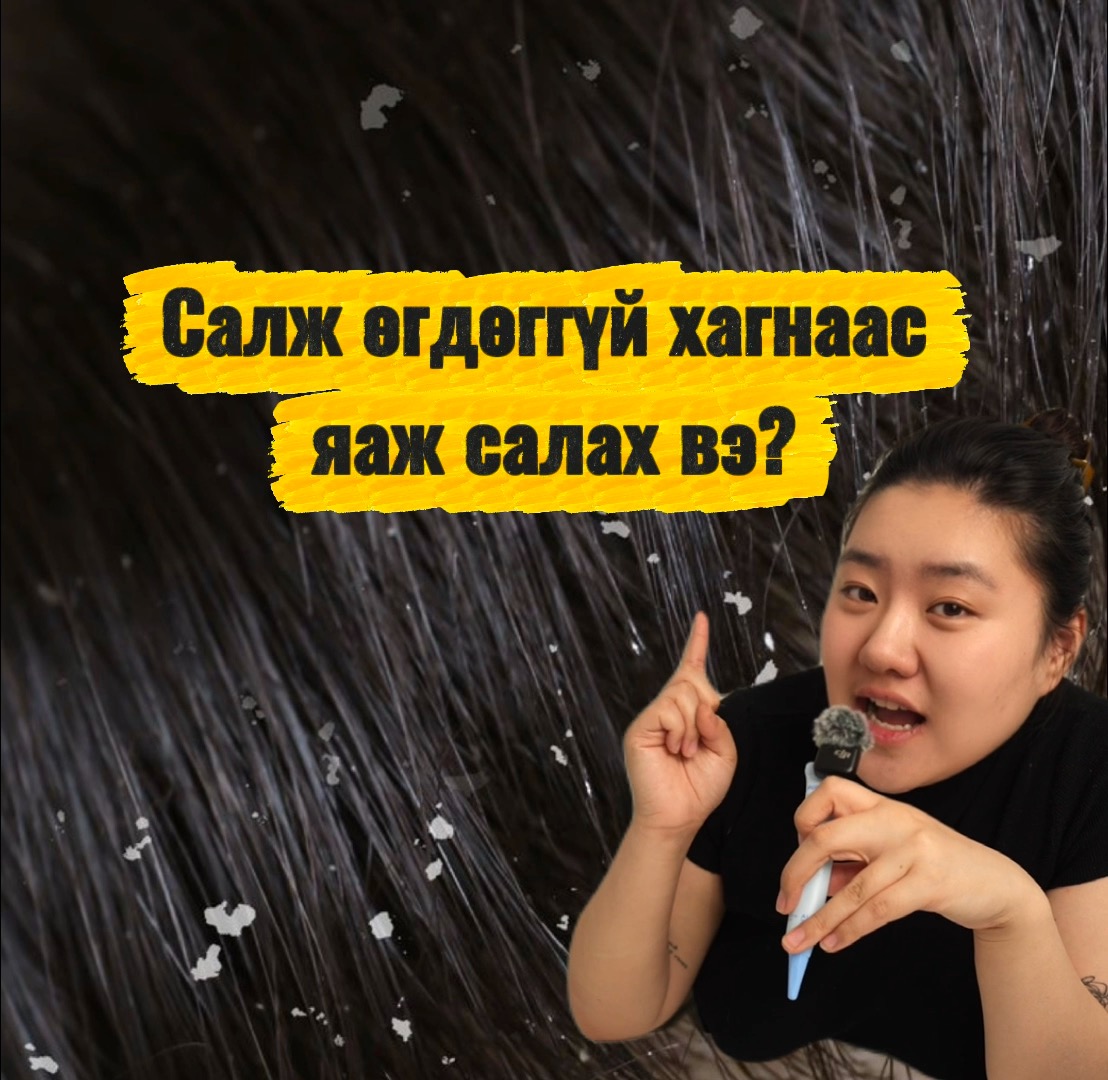 CleanBeauty.MN Facebook ad: Салж өгдөггүй хаг, тэвчихийн аргагүй загатнаа…