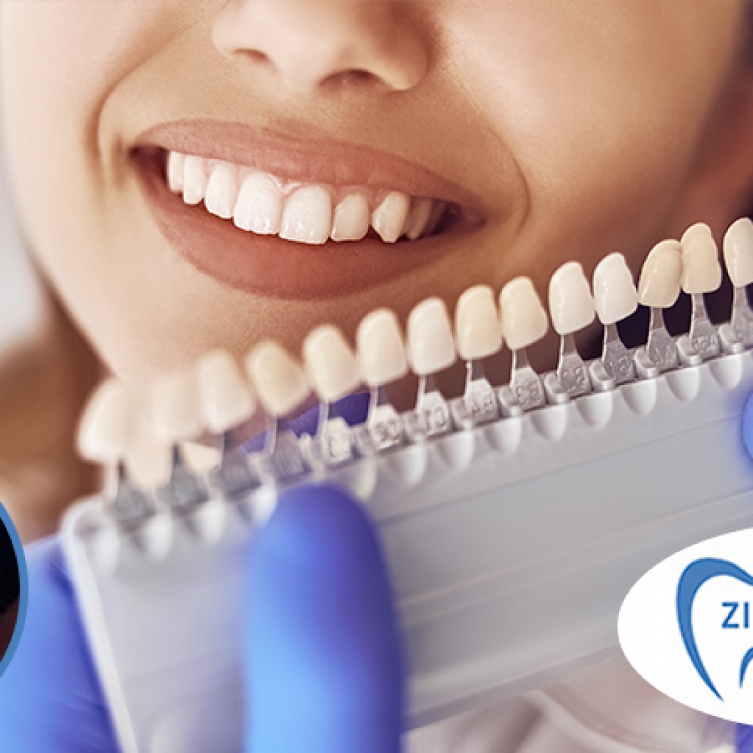 Cupón Club El Salvador Facebook ad: Tu salud dental es lo más importante y…