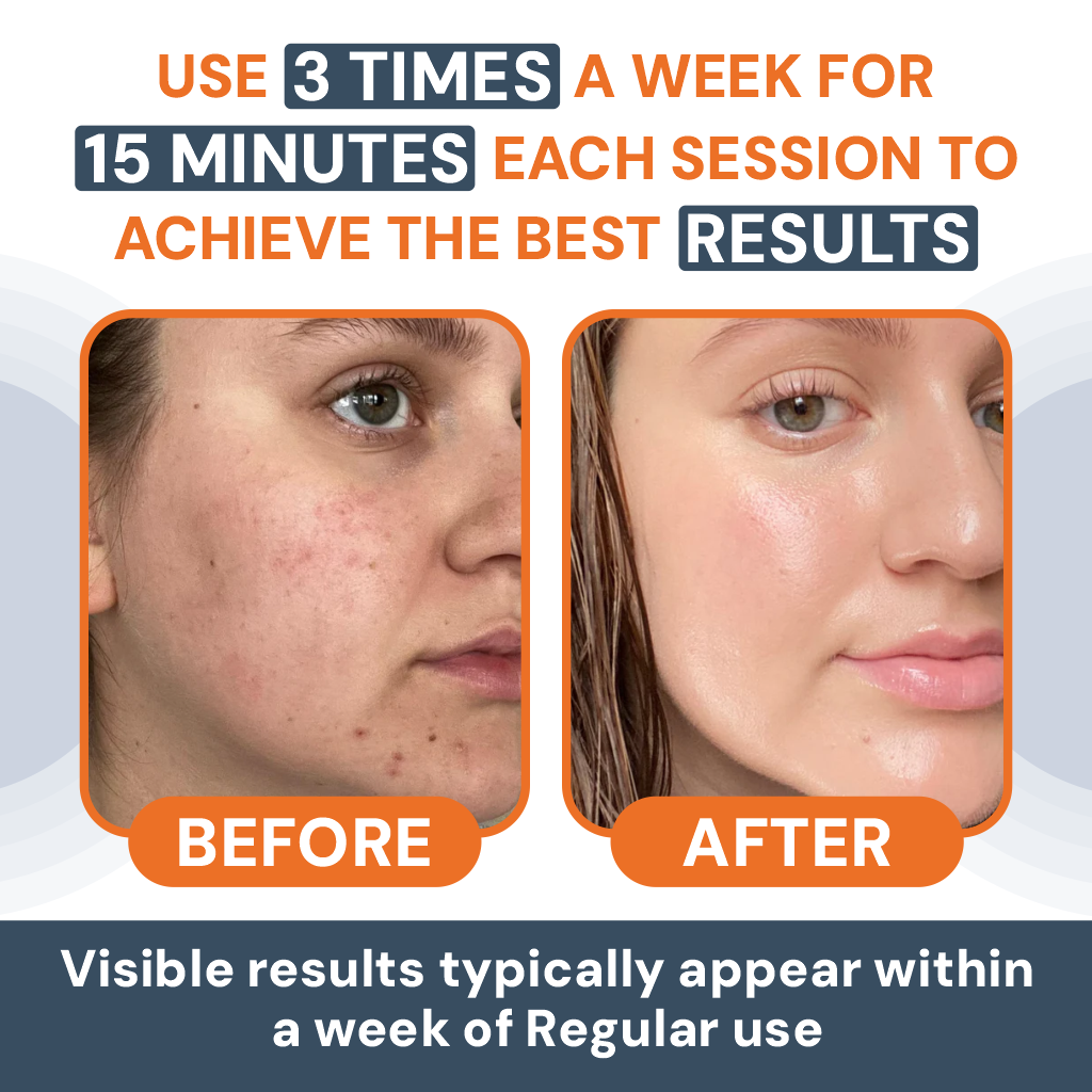 Crystal Remover Facebook ad