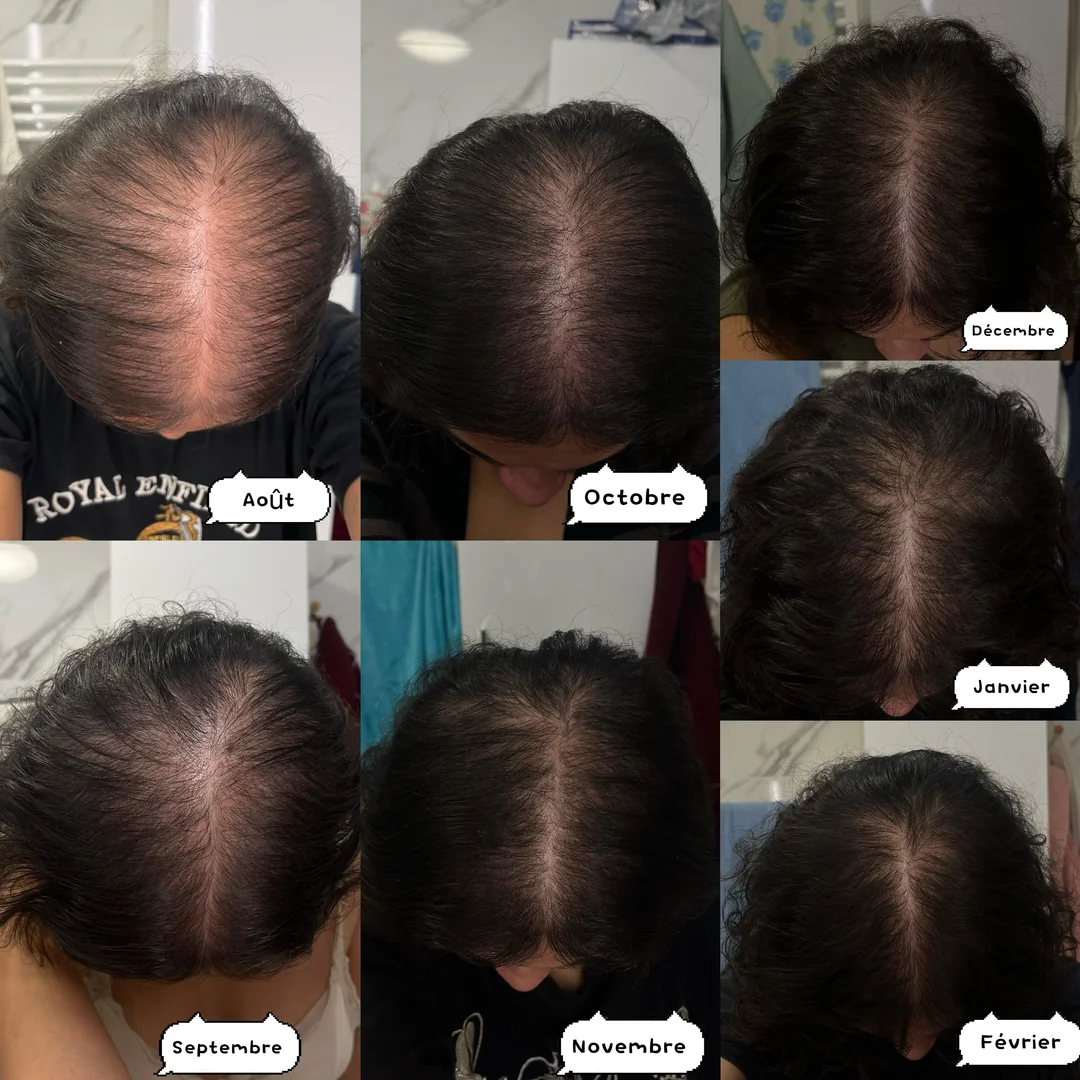 Thyroid Hair Secrets Facebook ad: Read this if the medication that's supposed to help is…