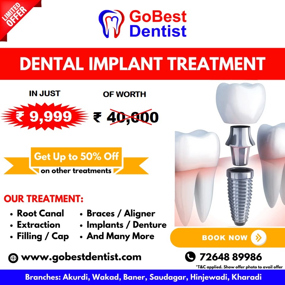 GoBest Dentist Facebook ad