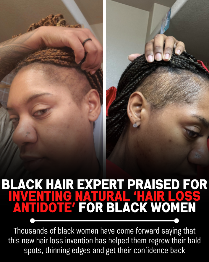Black Hair Growth Remedy Facebook ad