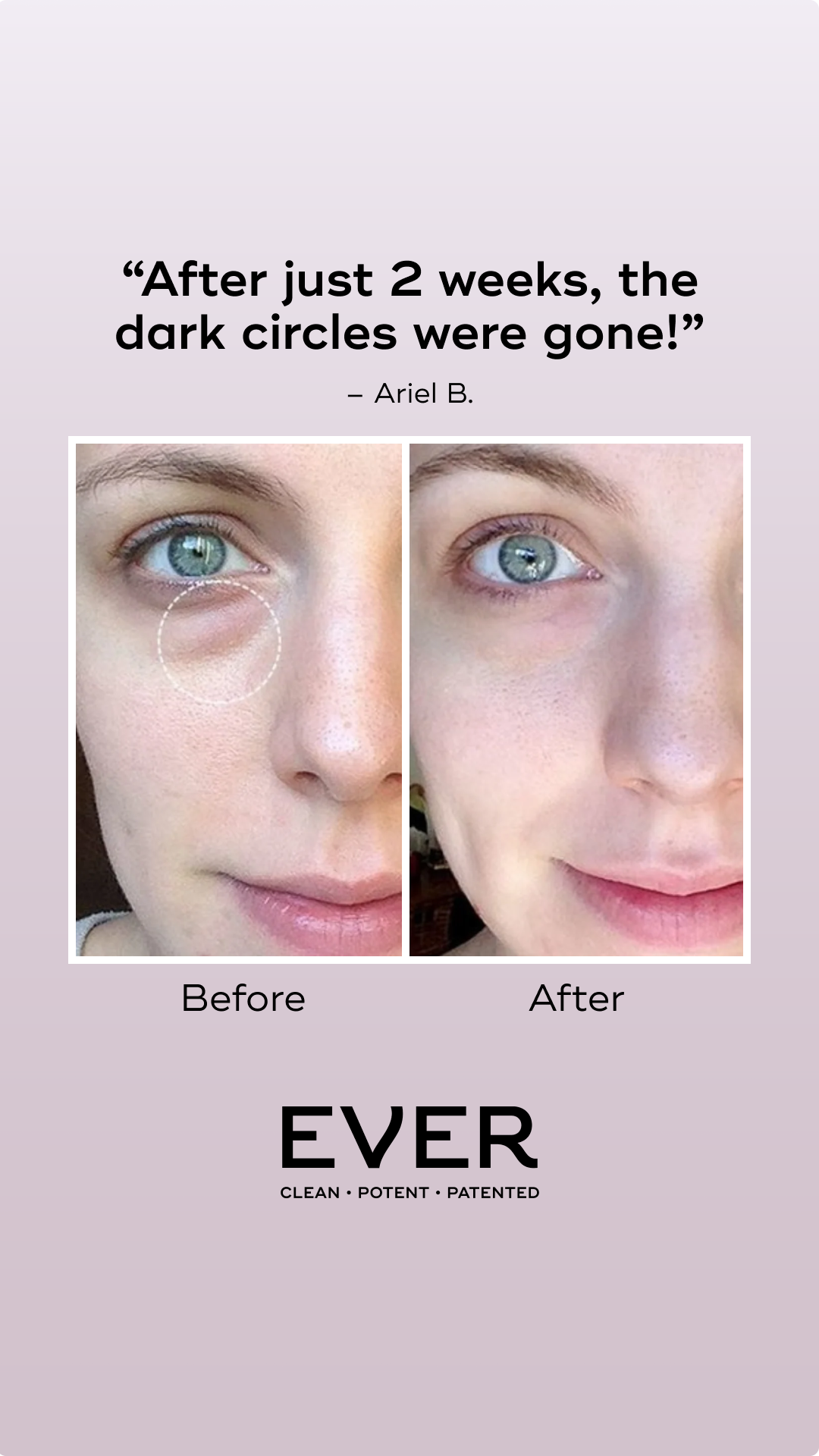 EVER Cleanical Skincare Facebook ad