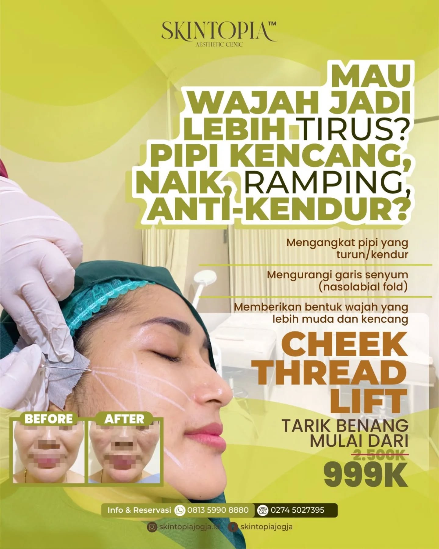 Skintopia Klinik Facebook ad: Pipi kendur? Garis senyum makin dalam?